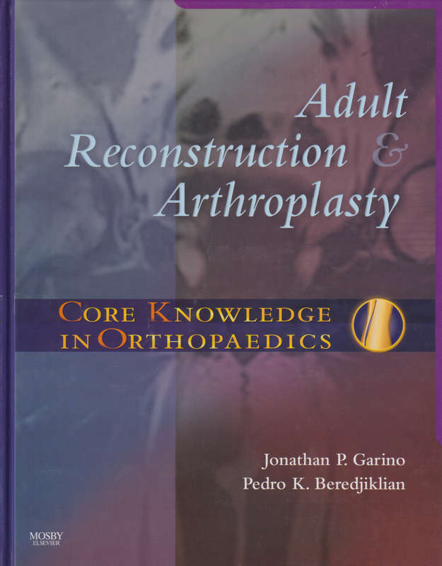 Core Knowledge in Orthopaedics: Adult Reconstruction and Arthroplast - Jonathan P. Garino