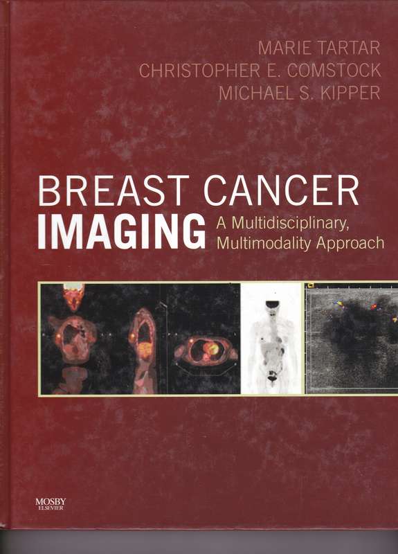 BREAST CANCER IMAGING SECONDHAND - TARTAR,M