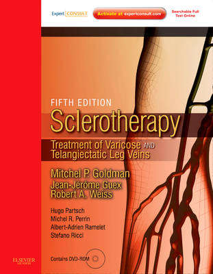 Sclerotherapy - Mitchel Goldman