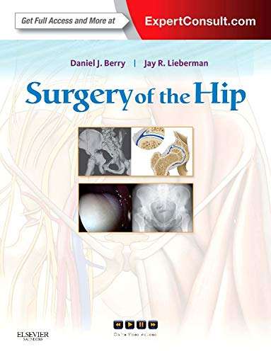Surgery of the Hip - Daniel J. Berry