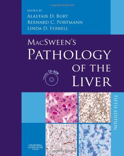 MacSween's Pathology of the Liver - BURT,A