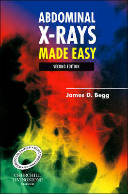 Abdominal X-Rays Made Easy International Edition - Dr. James D. Begg