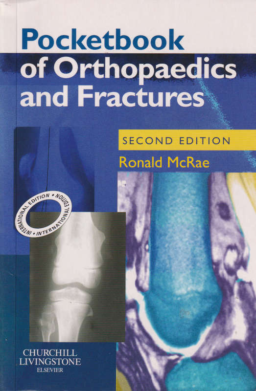 Pocketbook of Orthopaedics and Fractures International Edition - Ronald McRae