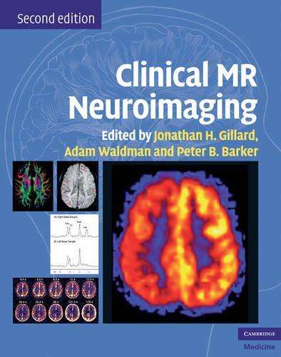 Clinical MR Neuroimaging - GILLARD,J