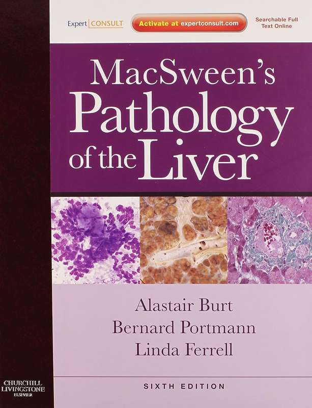 MacSween's Pathology of the Liver - Stefan G. Hubscher