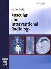 Vascular and Interventional Radiology - Karim Valji
