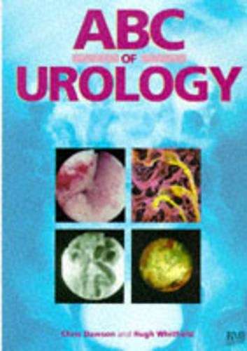ABC OF UROLOGY SECONDHAND - DAWSON