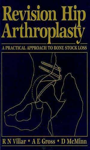Revision Hip Arthroplasty - Richard N. Villar