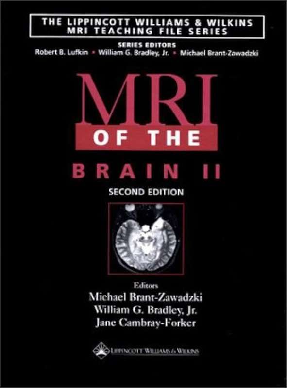 MRI of the Brain: v. 2 - BRANT-ZAWADZKI,M