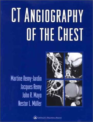 CT Angiography of the Chest - Martine Remy-Jardin