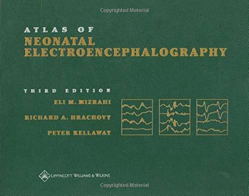 Atlas of Neonatal Electroencephalography - Eli M. Mizrahi