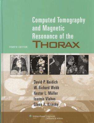 Computed Tomography and Magnetic Resonance of the Thorax - Monvadi B. Srichai