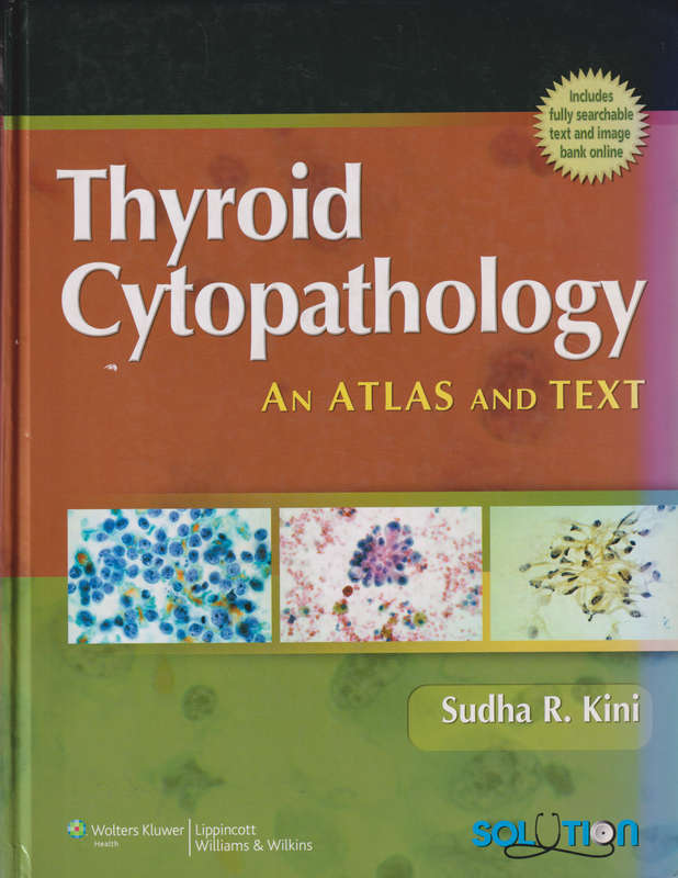 THYROID CYTOPATHOLOGY - KINI,S