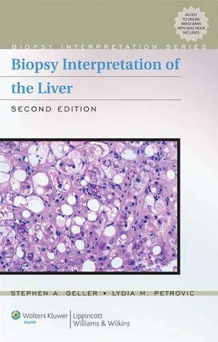 Biopsy Interpretation of the Liver - Stephen A. Geller