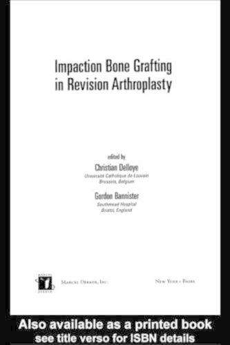 Impaction Bone Grafting in Revision Arthroplasty - DELLOYE,C