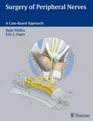 Surgery of Peripheral Nerves - Rajiv Midha
