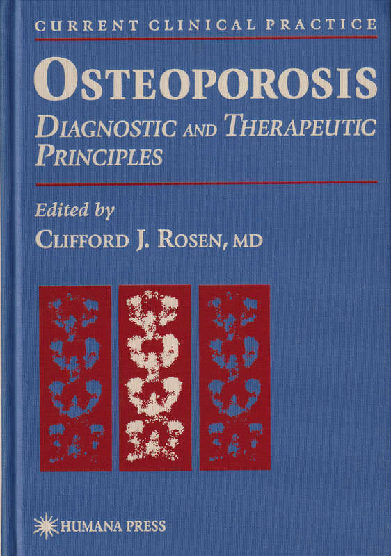 OSTEOPOROSIS DIAGNOSTIC & THERAPEUTIC - ROSEN