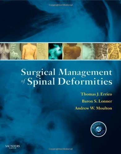 Surgical Management of Spinal Deformities - Thomas J. Errico