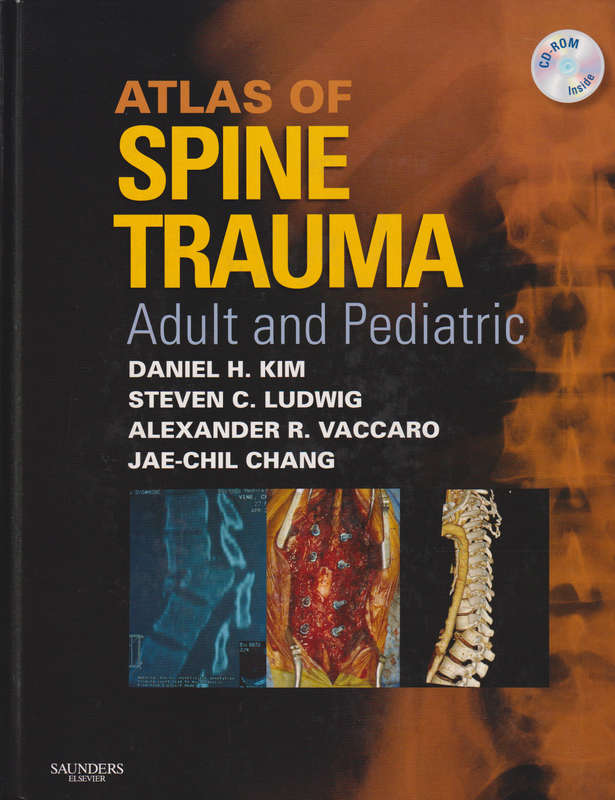 Atlas of Spine Trauma - Daniel H. Kim