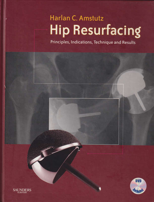 Hip Resurfacing - Harlan C. Amstutz