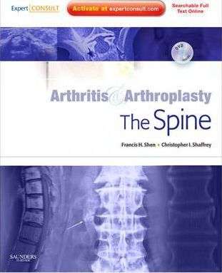 Arthritis and Arthroplasty: The Spine - Francis H. Shen
