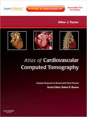 Atlas of Cardiovascular Computed Tomography: Expert Consult - Online - Allen J. Taylor