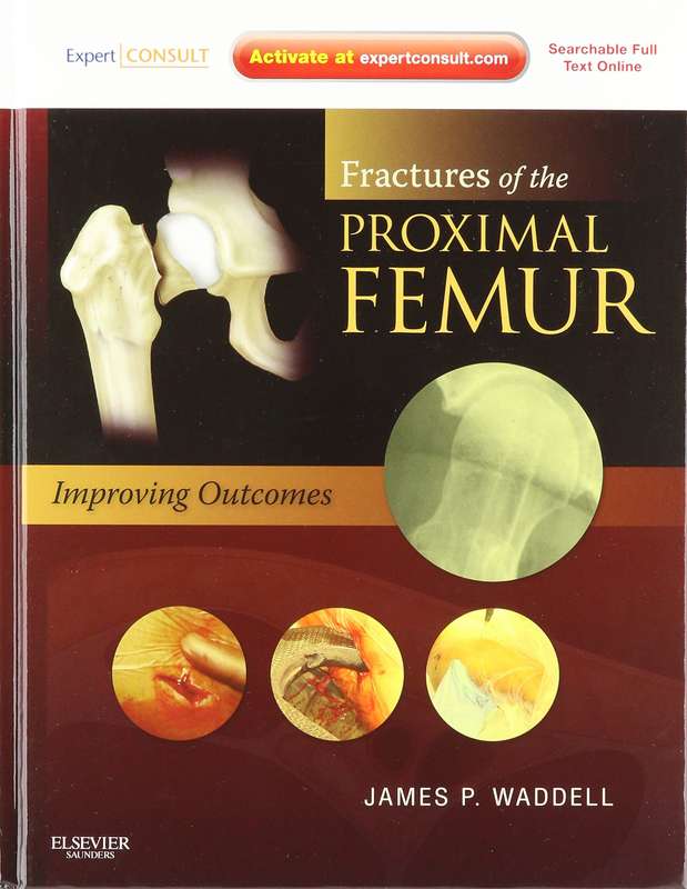 FRACTURES OF THE PROXIMAL FEMUR IMPROV - WADDEL,J