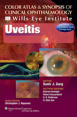 Color Atlas and Synopsis of Clinical Ophthalmology - Wills Eye Insti - Sunir J. Garg