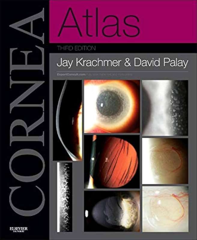 Cornea Atlas - Jay H. Krachmer