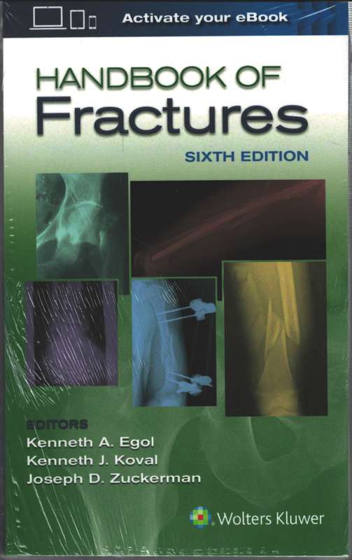 Handbook of Fractures 6th Edition - Kenneth A. Egol, Kenneth J.