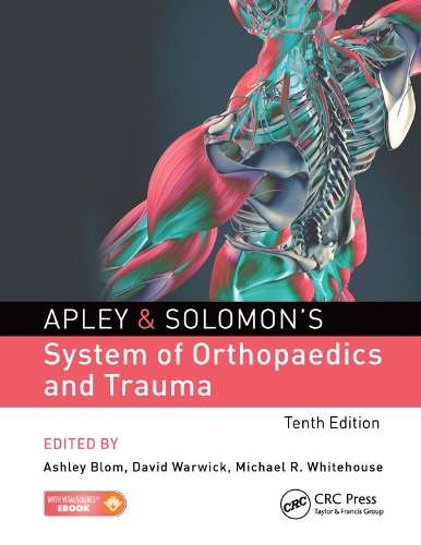 Apley & Solomon's System of Orthopaedics and Trauma - SOLOMON