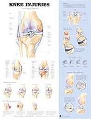 Knee Injuries Anatomical Chart - POSTER