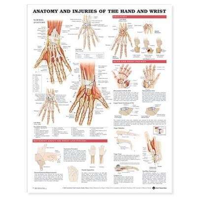 Anatomy and Injuries of the Hand and Wrist Anatomical Chart - POSTER
