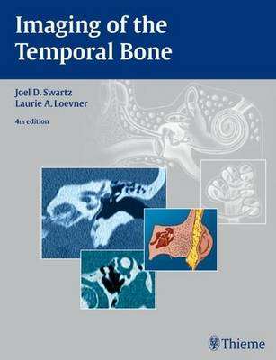 Imaging of the Temporal Bone - SWARTS,J