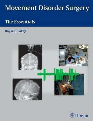 Movement Disorder Surgery - BAKAY,R