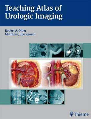 Teaching Atlas of Urologic Imaging - OLDER,A