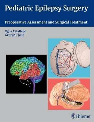 Pediatric Epilepsy Surgery - JALLO,G