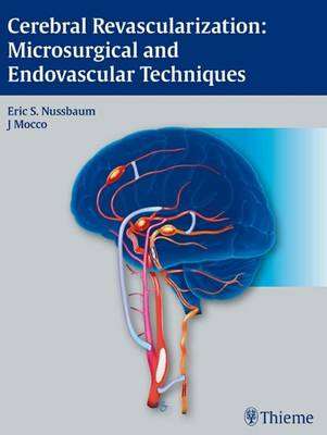 Cerebral Revascularization: Microsurgical and Endovascular Technique - NUSSBAUM,E