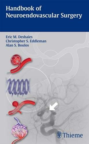 Handbook of Neuroendovascular Surgery - DESHAIES,E