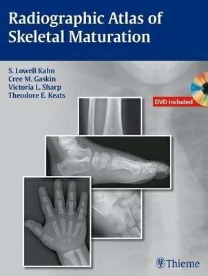 Radiographic Atlas of Skeletal Maturation - S. Lowell Kahn