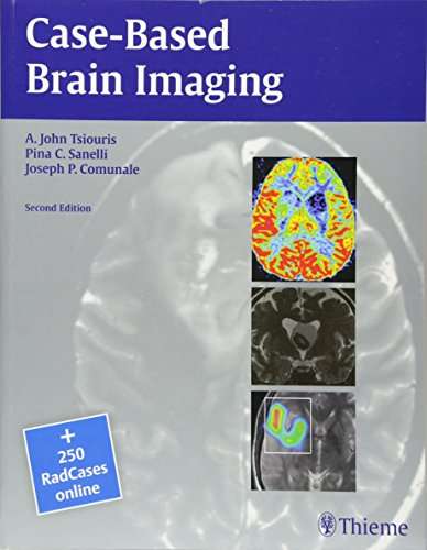 Case-Based Brain Imaging - Apostolos John Tsiouris