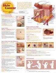 Understanding Skin Cancer Anatomical Chart - E-9998