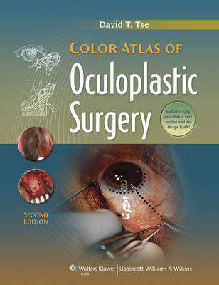 Color Atlas of Oculoplastic Surgery - David T. Tse