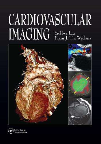 Cardiovascular Imaging - Yi-Hwa Liu
