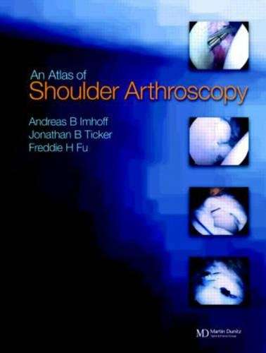 Atlas of Shoulder Arthroscopy - IMHOFF,A
