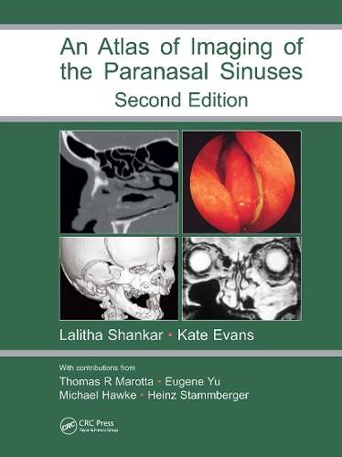 Atlas of Imaging of the Paranasal Sinuses Second Edition - SHANKAR,L