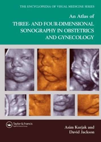 An Atlas of Three- and Four-Dimensional Sonography in Obstetrics and - Asim Kurjak