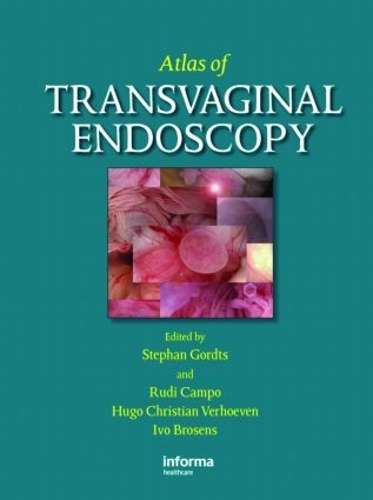 Atlas of Transvaginal Endoscopy - GORDTS,S