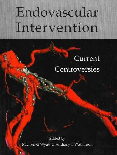 Endovascular Intervention Current Controversies - WYATT,M