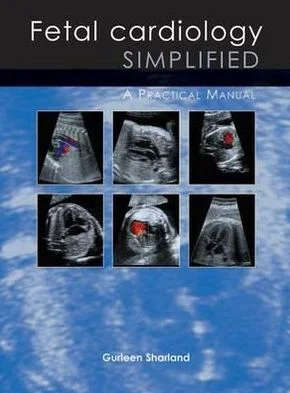 Fetal Cardiology Simplified - SHARLAND,G